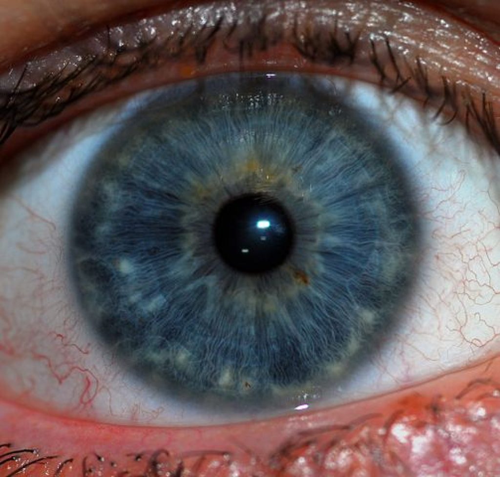 503px-Human_Iris_JD052007